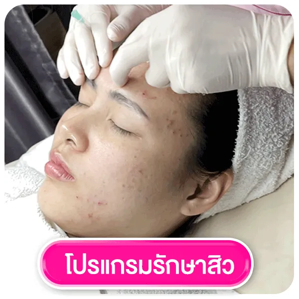 โปรแกรมรักษาสิว