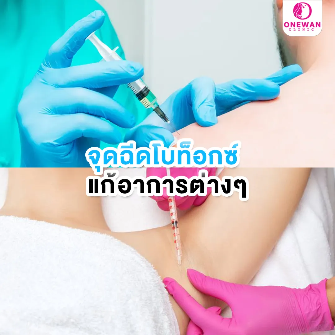 จุดฉีดโบท็อกแก้อาการต่าง ๆ