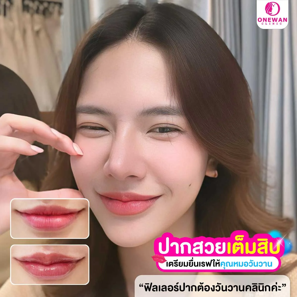รีวิวฉีดฟิลเลอร์ วันวาน คลินิกความงามบุรีรัมย์