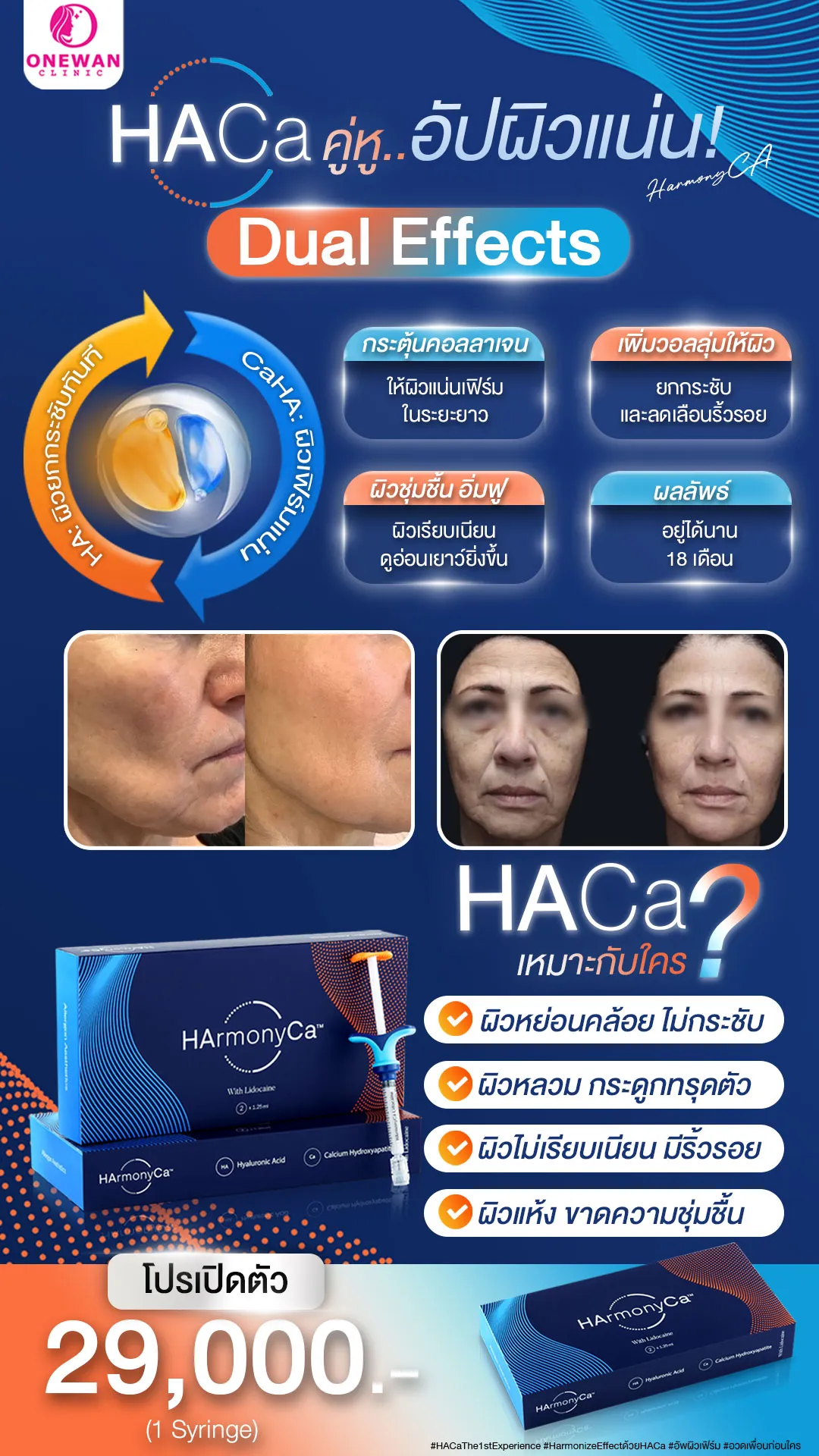 HaCa โปรโมชั่น