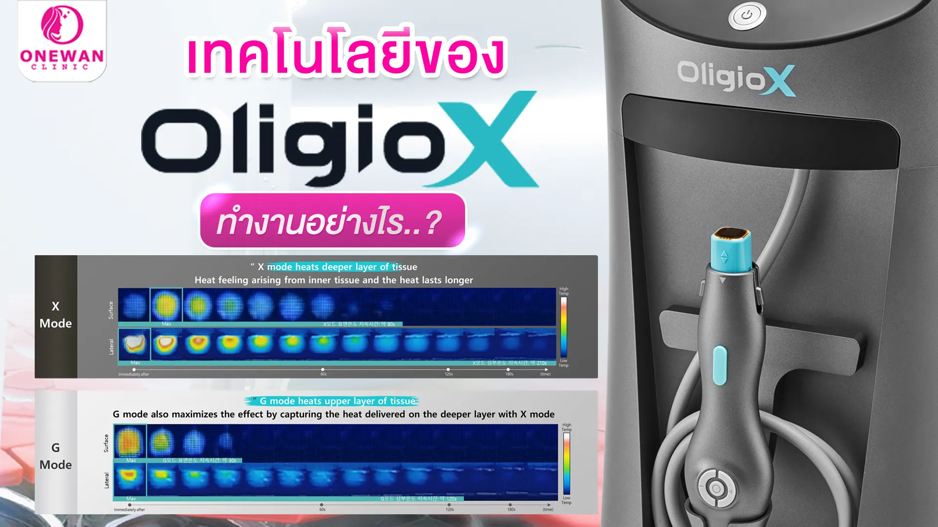 เทคโนโลยีของ OligioX ทำงานอย่างไร ?