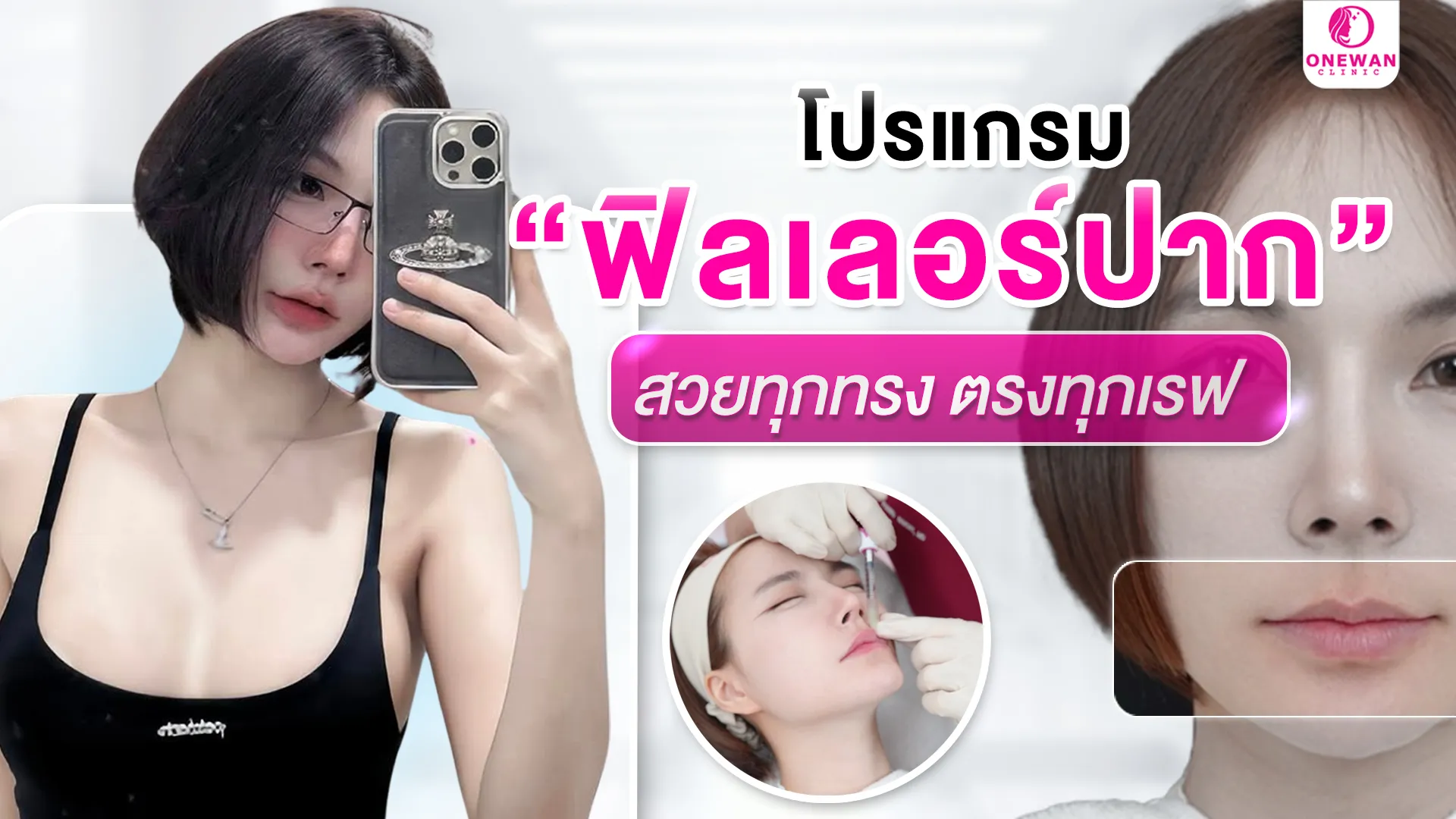 ฟิลเลอร์ปาก