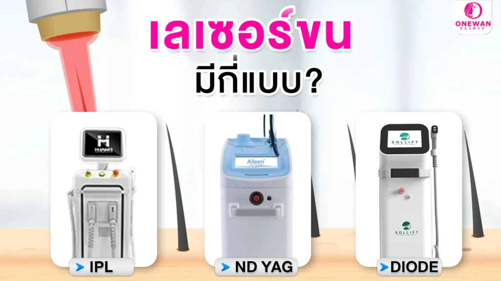 เลเซอร์ขนมีกี่แบบ