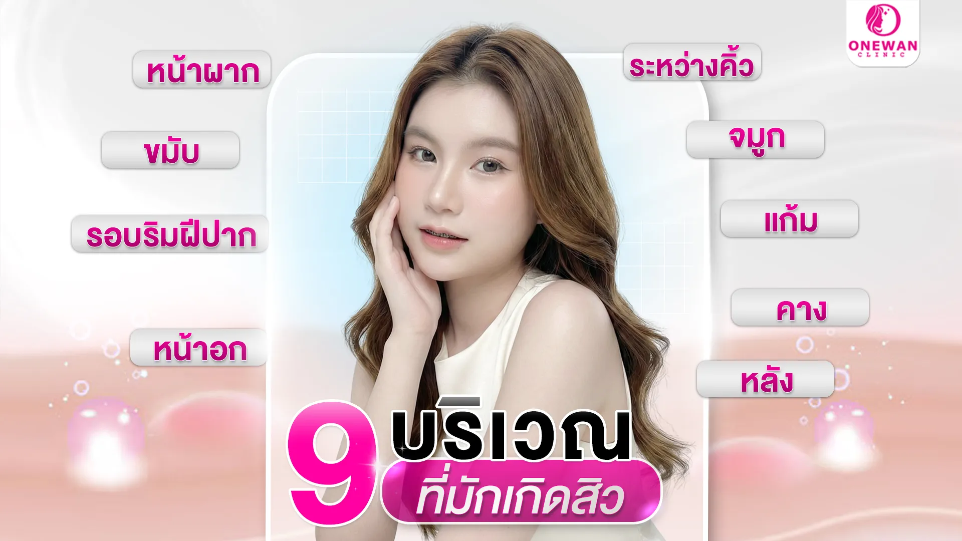 9 บริเวณที่มักเกิดสิว