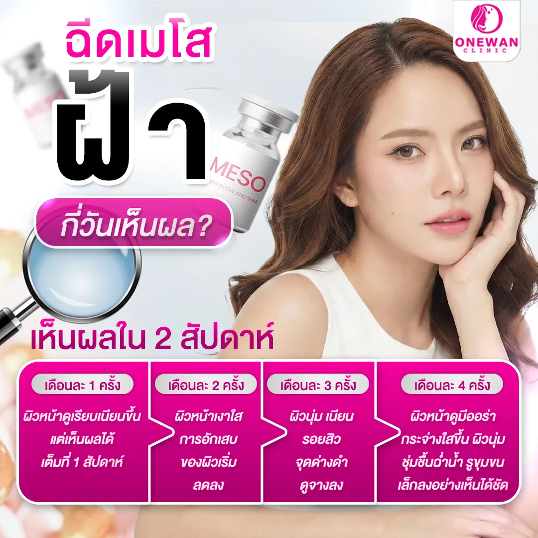ฉีดเมโสฝ้า กี่วันเห็นผล