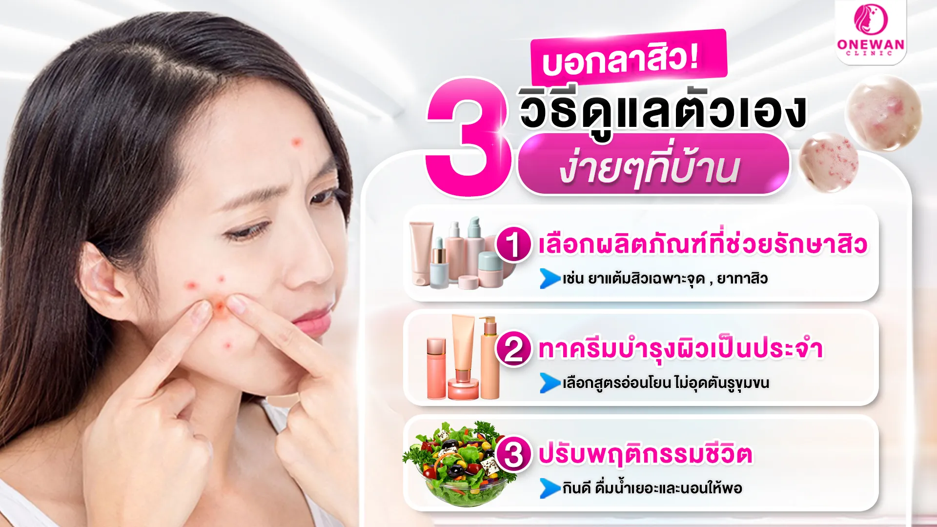 วิธีรักษาสิวด้วยตัวเอง