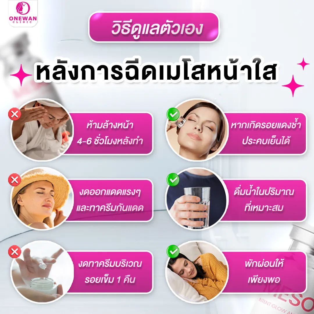 การดูแลตัวเองหลังจากฉีดเมโสหน้าใส