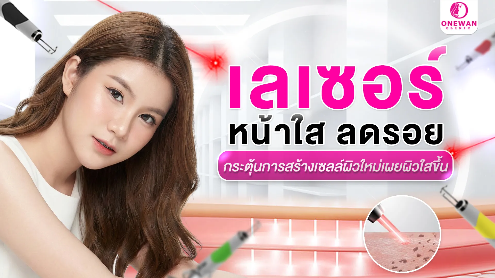 เลเซอร์ผิว