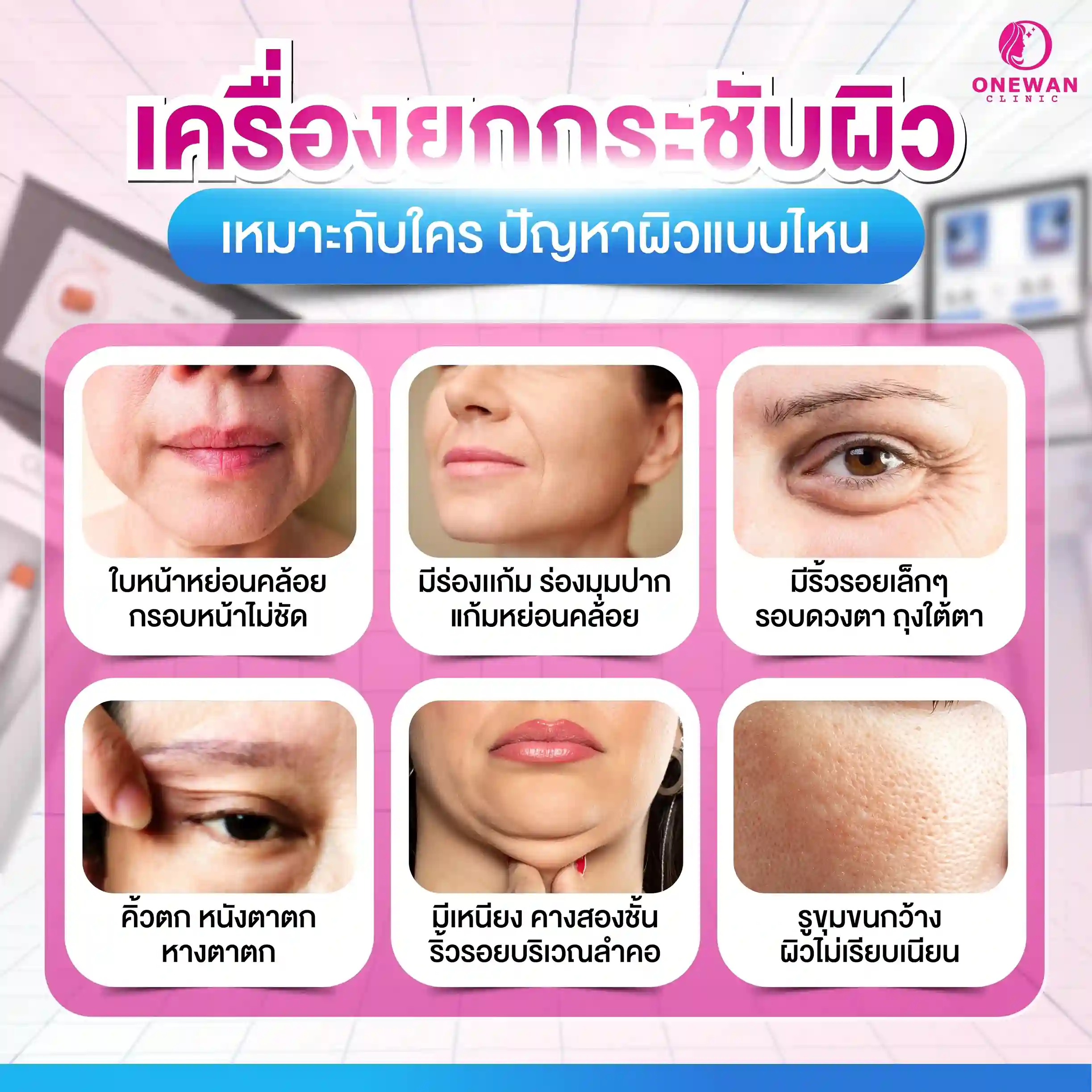 เครื่องยกกระชับผิว เหมาะกับใคร ปัญหาผิวแบบไหน