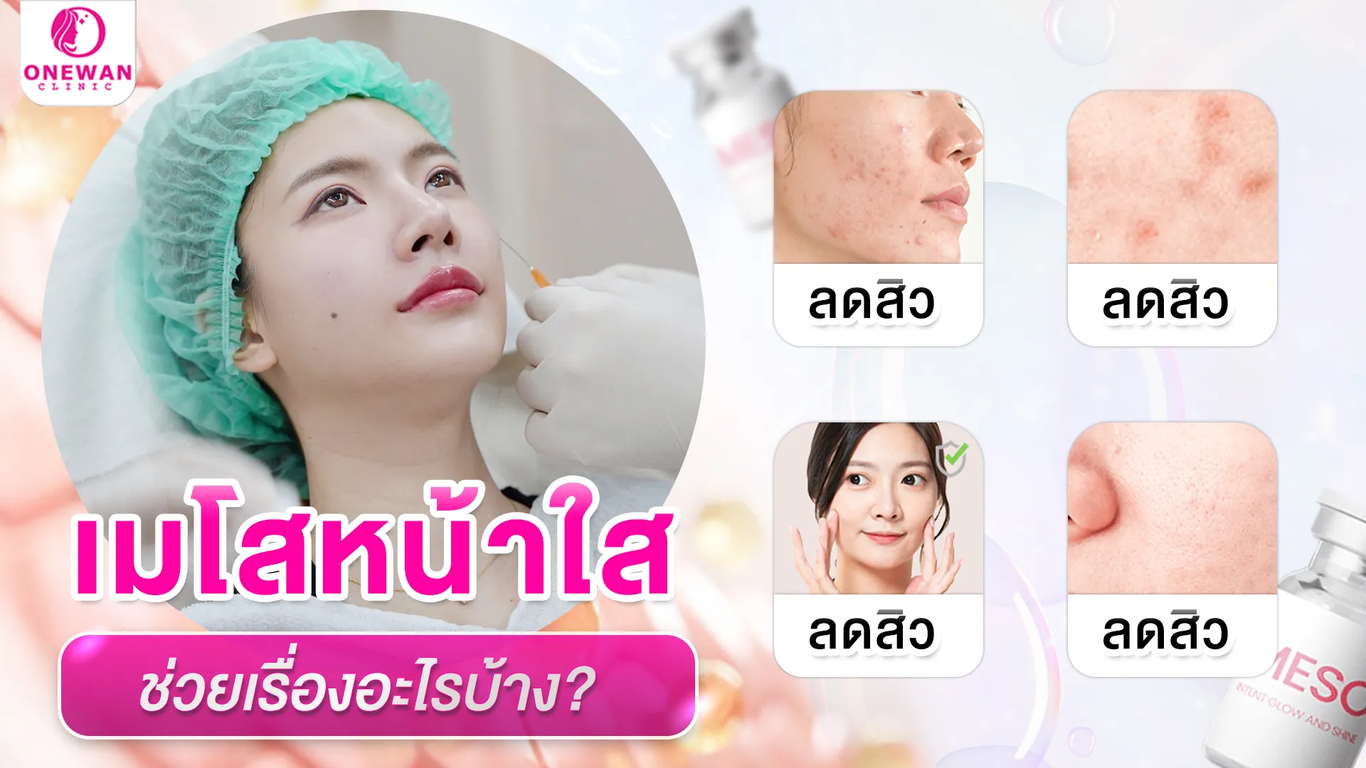 ฉีดเมโสหน้าใส ช่วยเรื่องอะไรบ้าง