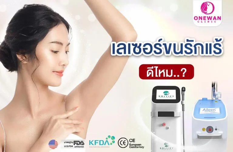 เลเซอร์รักแร้