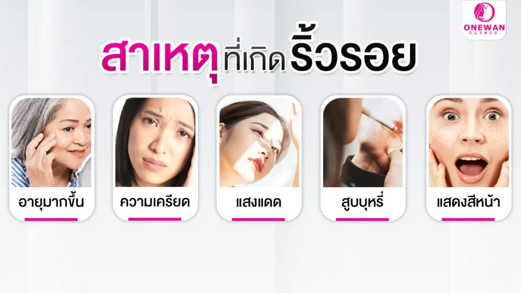 สาเหตุที่เกิดริ้วรอย