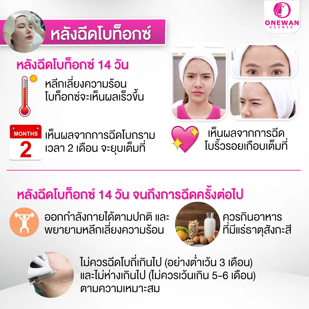 โบท็อกริ้วรอย หลังทำดูแลยังไง 2