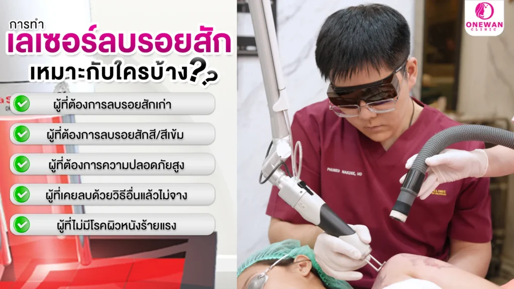 การทำเลเซอร์ลบรอยสัก เหมาะกับใครบ้าง