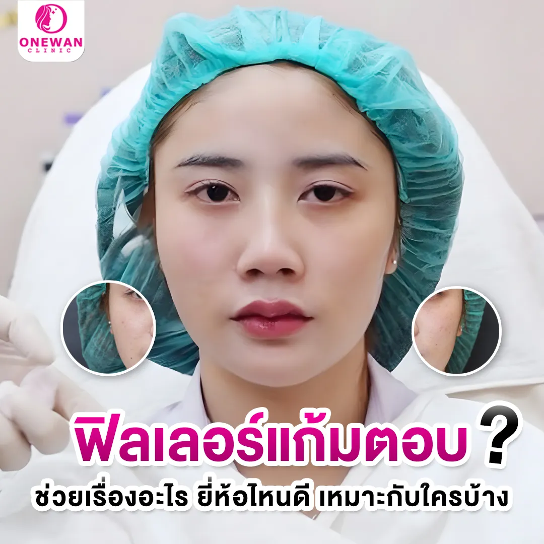 ฟิลเลอร์แก้มตอบ