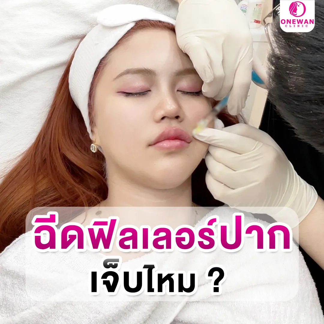 ฉีดฟิลเลอร์ปากเจ็บไหม