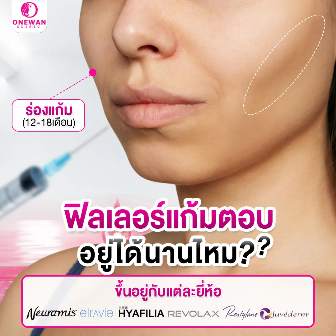 ฉีดฟิลเลอร์แก้มตอบอยู่ได้นานไหม