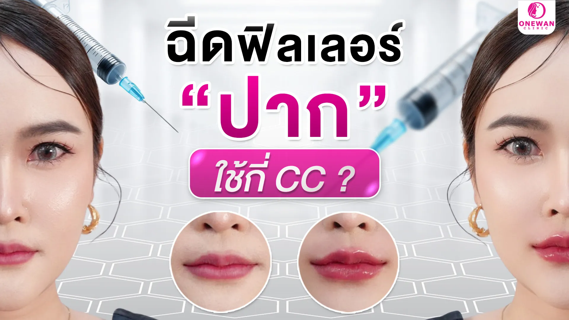 ฉีดฟิลเลอร์ปากใช้กี่ CC