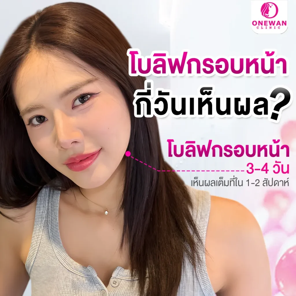 ฉีดโบท็อกลิฟกรอบหน้า กี่วันเห็นผล