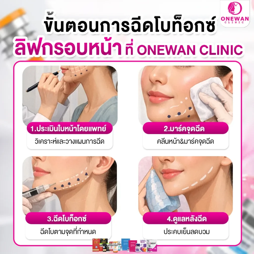 ขั้นตอนฉีดโบท็อกลิฟกรอบหน้า ที่ Onewan Clinic