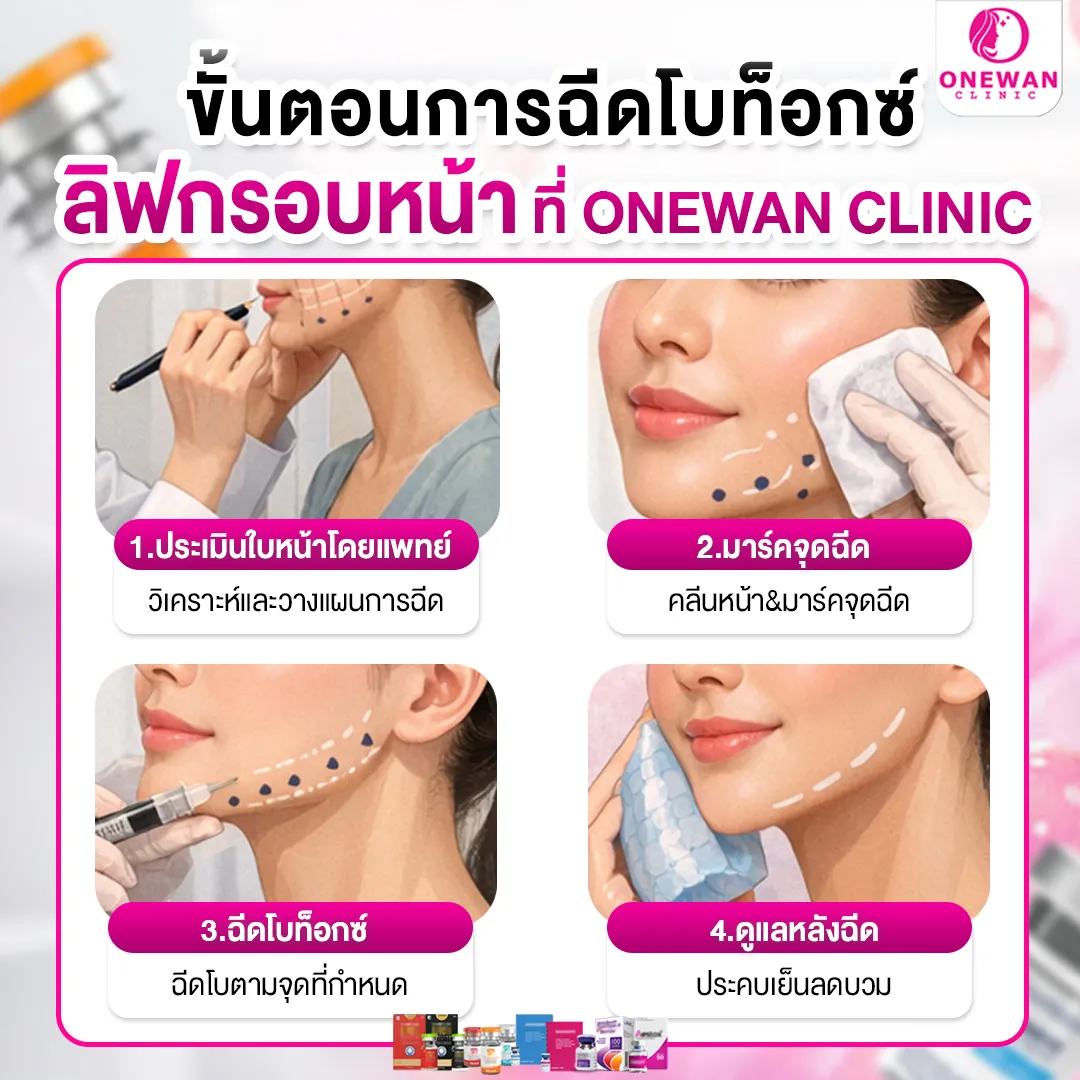 ขั้นตอนฉีดโบท็อกลิฟกรอบหน้า ที่ Onewan Clinic