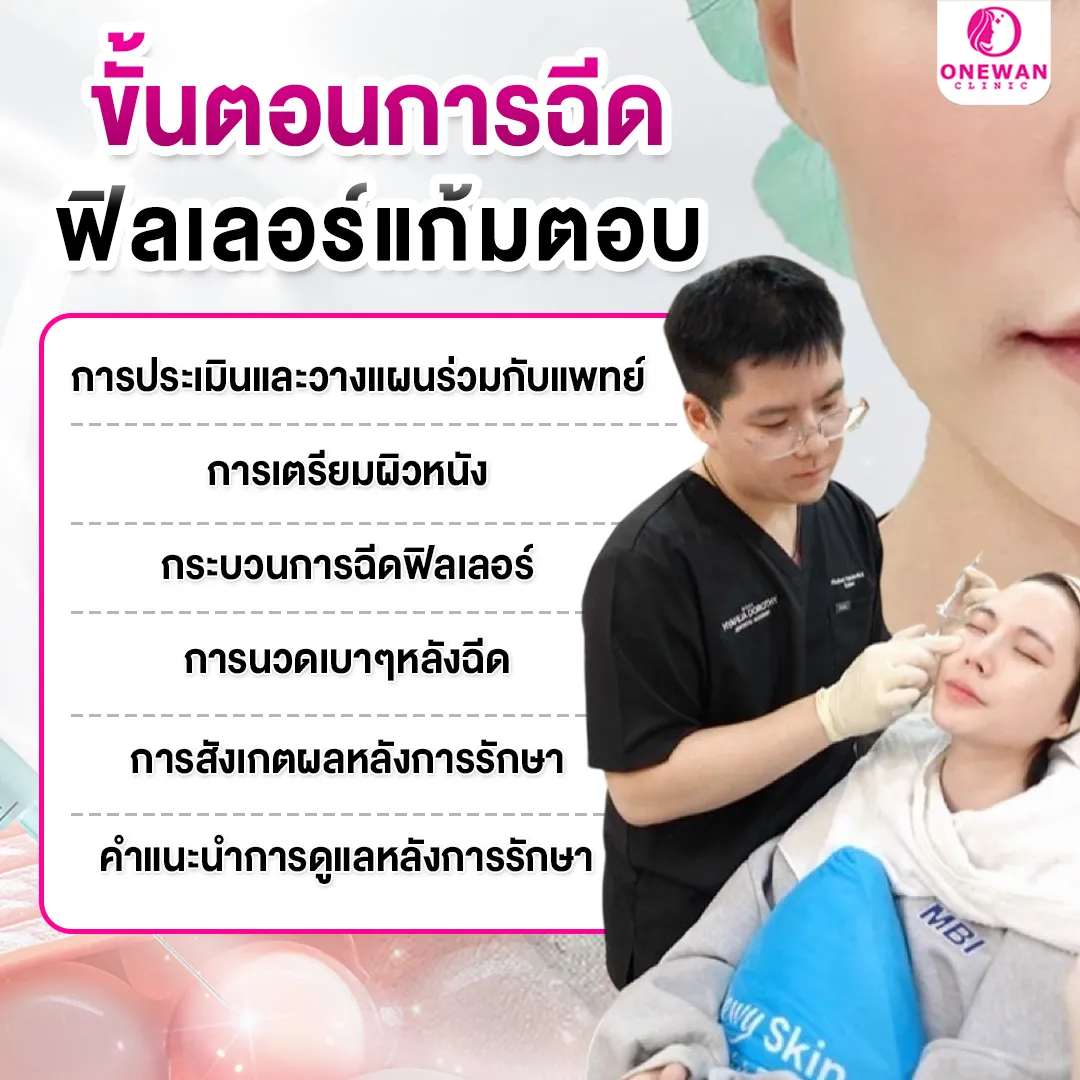 ขั้นตอนฉีดฟิลเลอร์แก้มตอบ