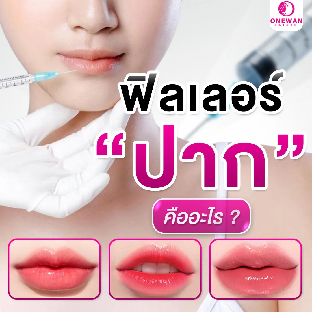 ฟิลเลอร์ปากคืออะไร