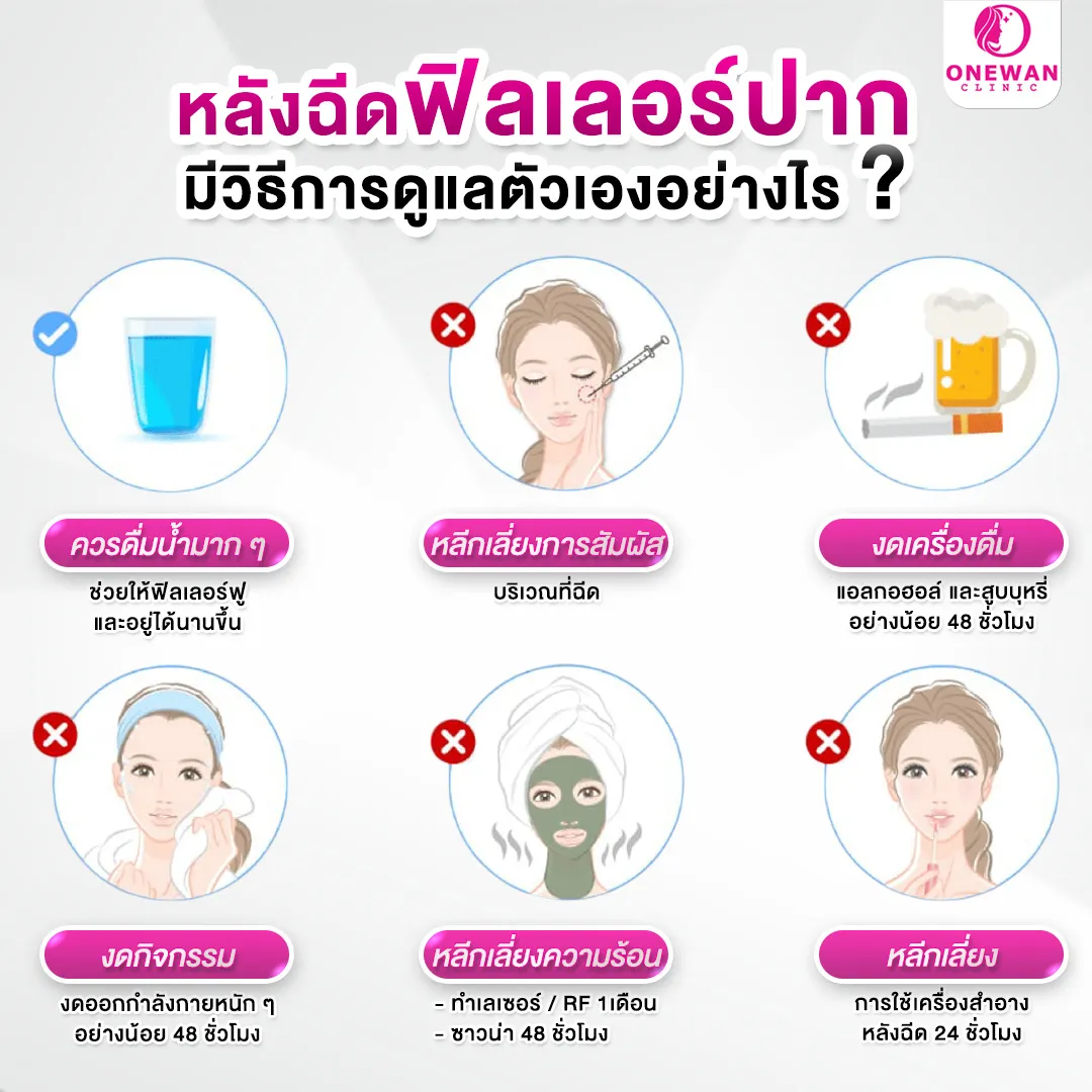 หลังฉีดฟิลเลอร์ปาก มีวิธีการดูแลตัวเองอย่างไร