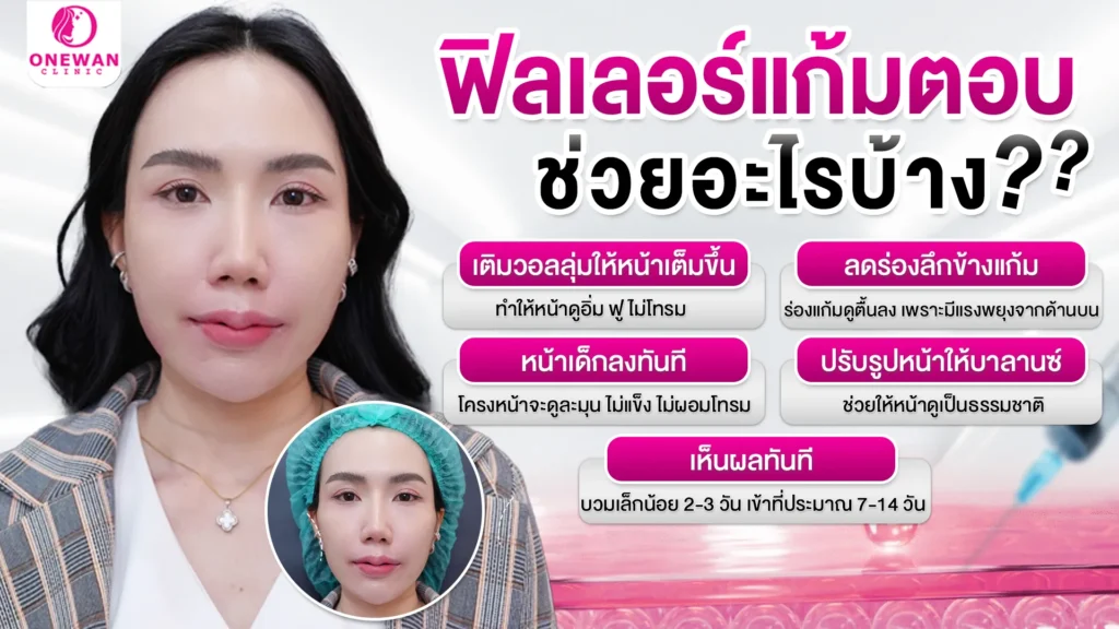 ฉีดฟิลเลอร์แก้มตอบ ช่วยอะไรบ้าง