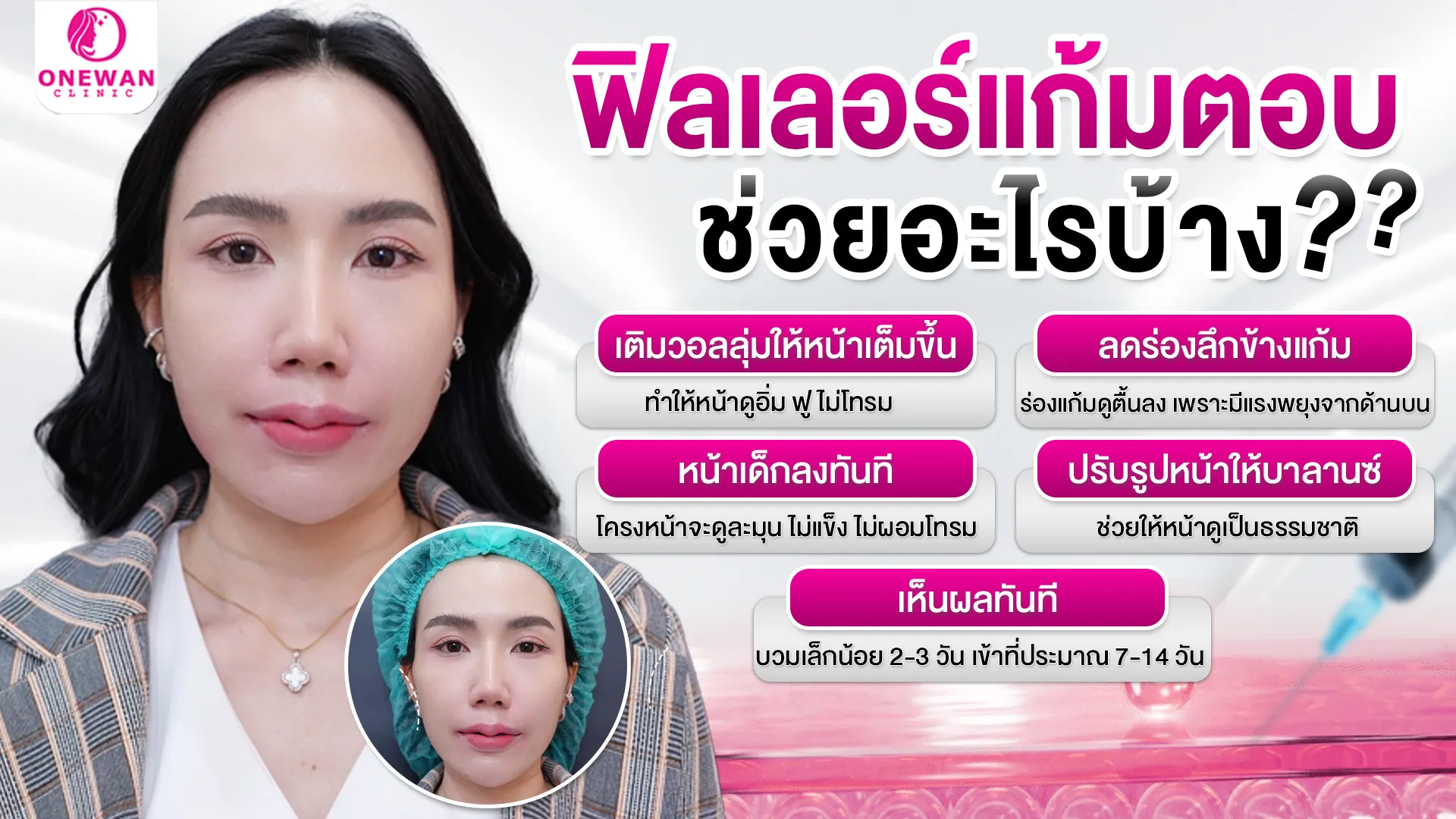 ฉีดฟิลเลอร์แก้มตอบ ช่วยอะไรบ้าง