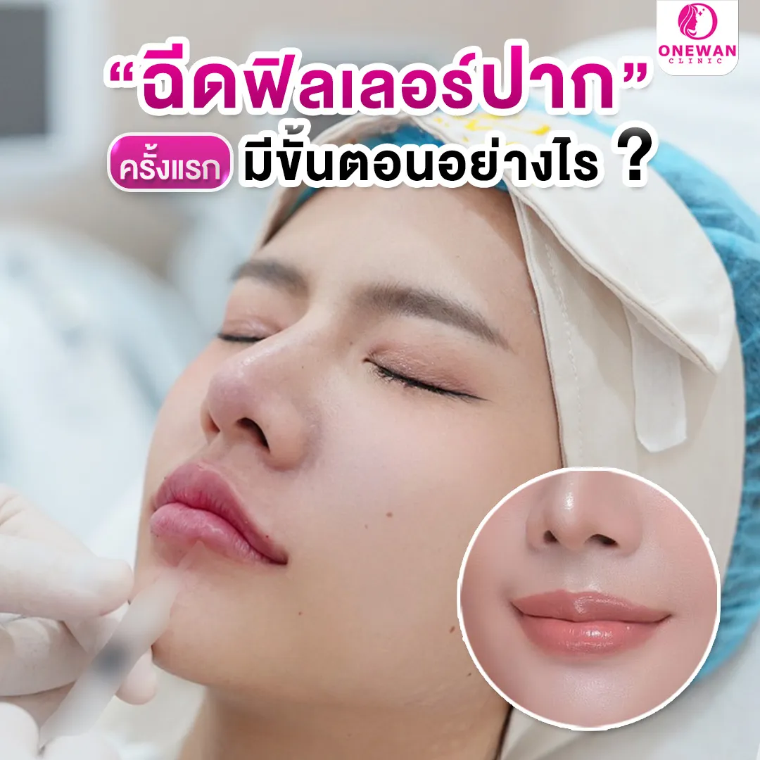 ฉีดฟิลเลอร์ปากครั้งแรก มีขั้นตอนอย่างไร