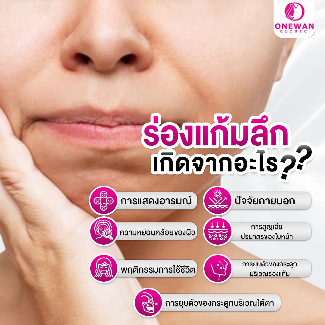 ร่องแก้มลึกเกิดจากอะไร