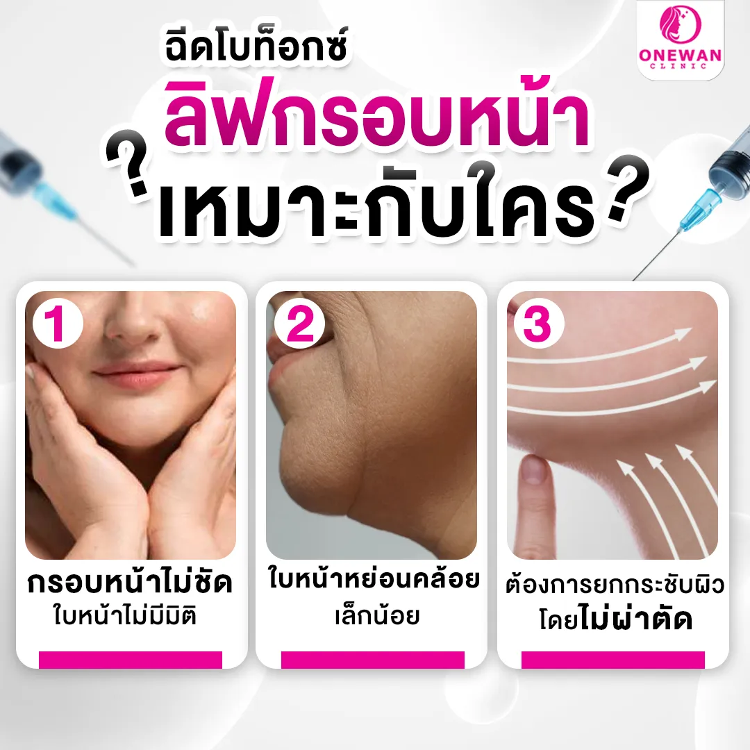 ฉีดโบท็อกลิฟกรอบหน้า เหมาะกับใคร