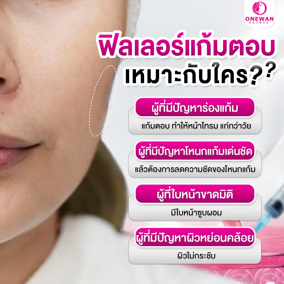 ฟิลเลอร์แก้มตอบเหมาะกับใคร