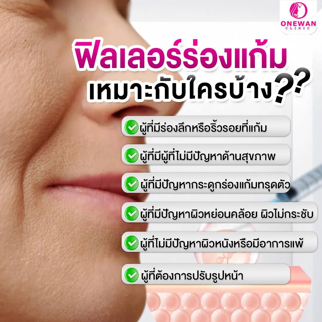 การฉีดฟิลเลอร์ร่องแก้ม เหมาะกับใคร