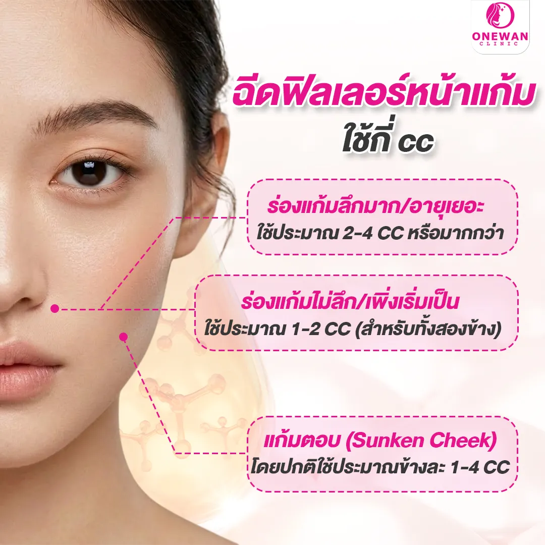 ฉีดฟิลเลอร์หน้าแก้ม ใช้กี่ cc