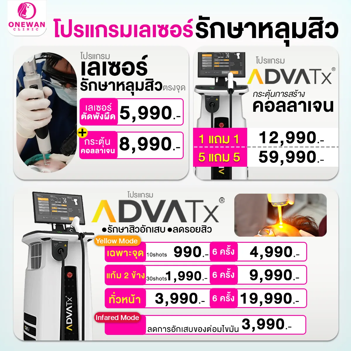 Promotion 4.4 Laser Acne
