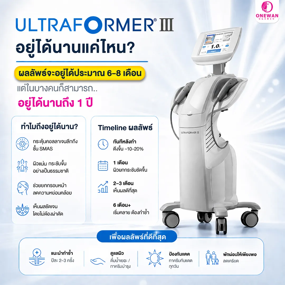 Ultraformer III อยู่ได้นานไหม