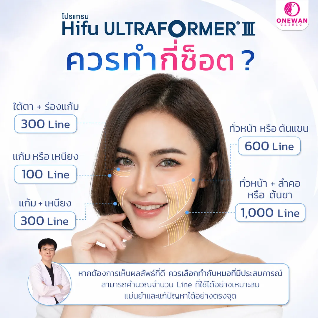 Ultraformer III ควรทำกี่ช็อต
