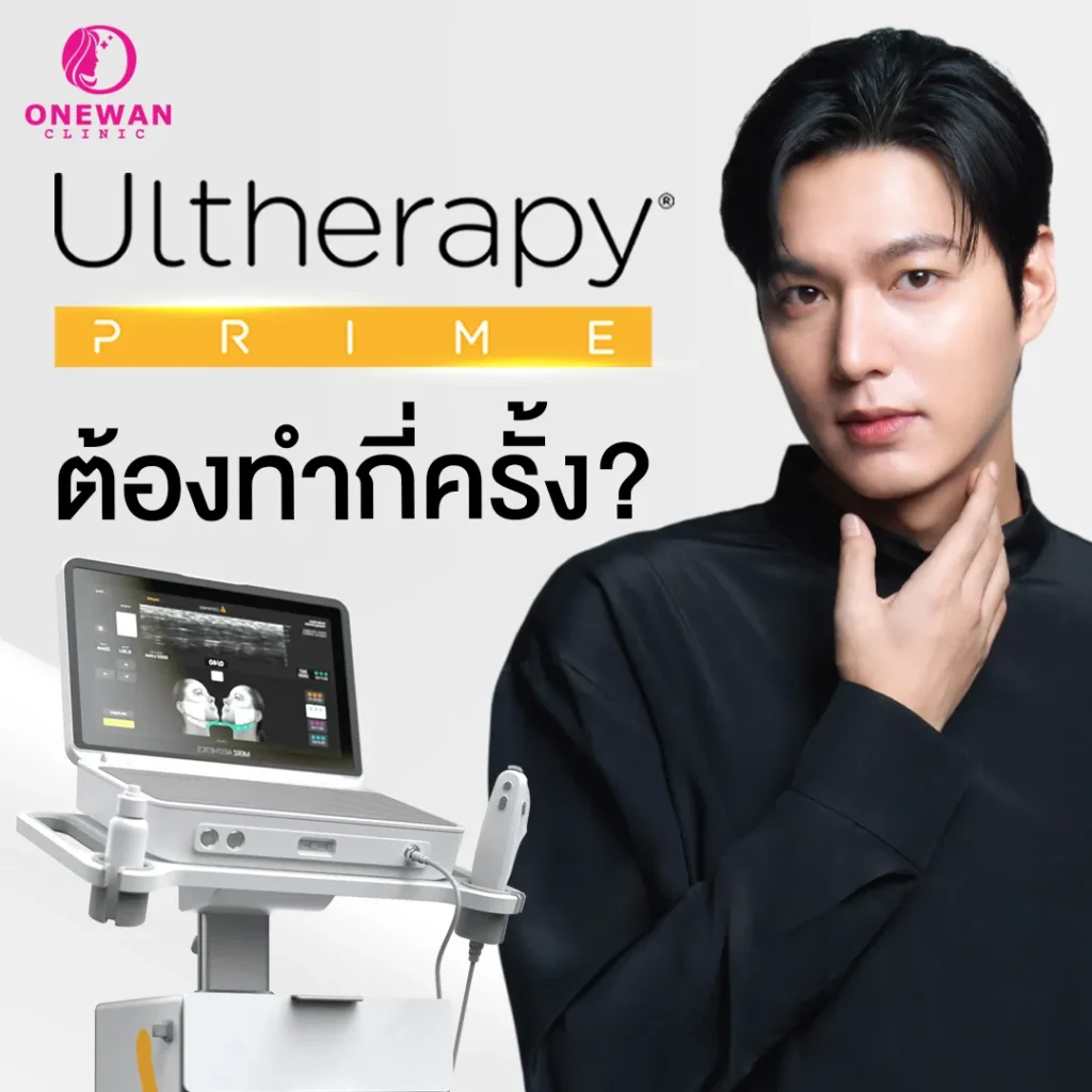ต้องทำกี่ครั้ง Ulthera Prime