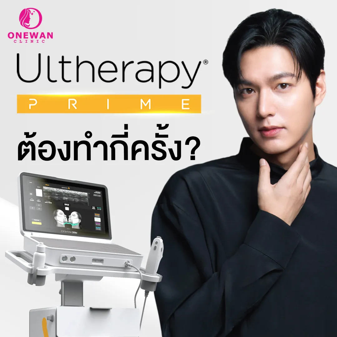 ต้องทำกี่ครั้ง Ulthera Prime