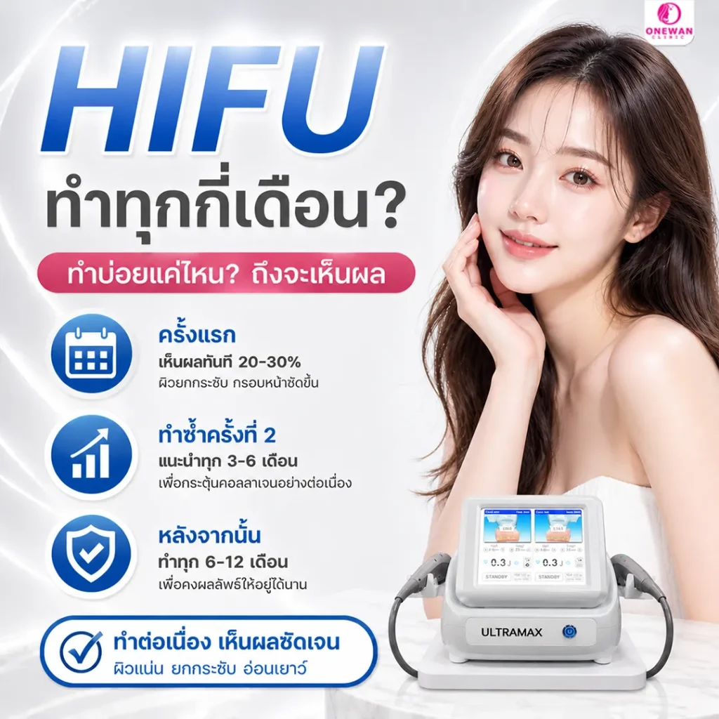 HIFU ทำทุกกี่เดือน
