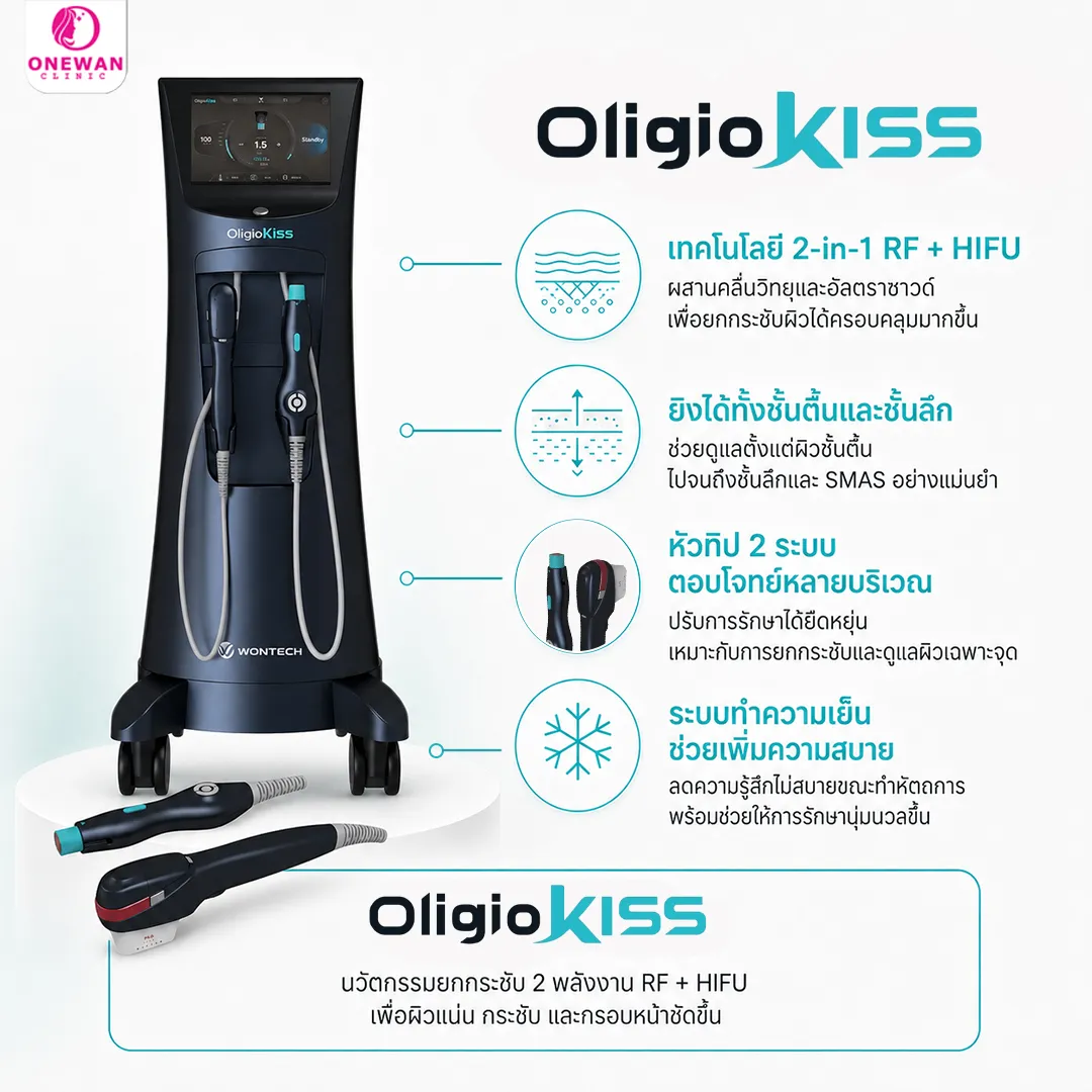 Oligio Kiss