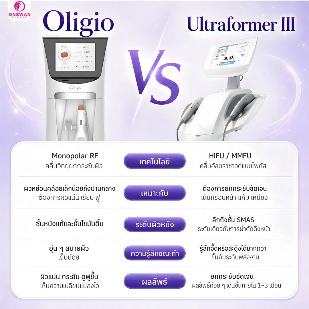 Oligio VS Ultraformer III