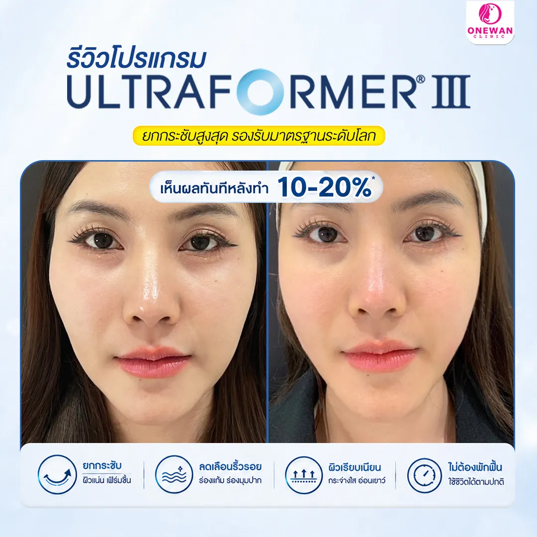 Review 2 Ultraformer III