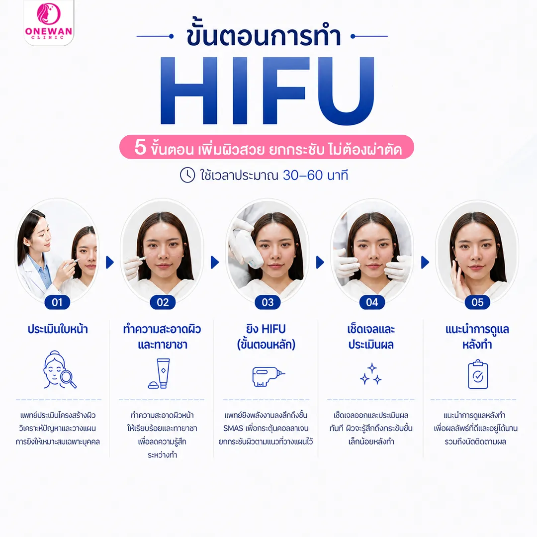 ขั้นตอนการทำ Hifu