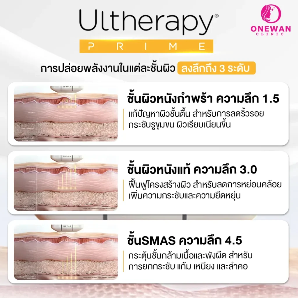 กระบวนการทำงานของ Ulthera Prime