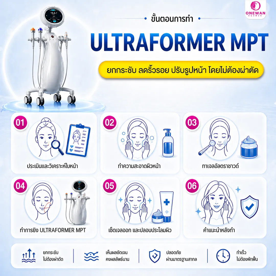 ขั้นตอนการทำ Ultraformer MPT