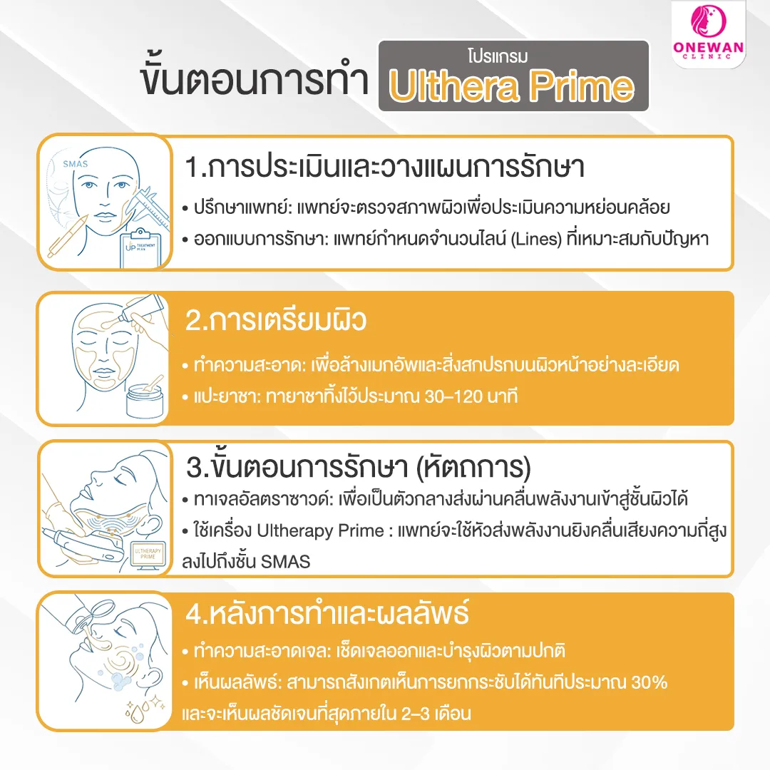ขั้นตอนการทำ Ulthera Prime