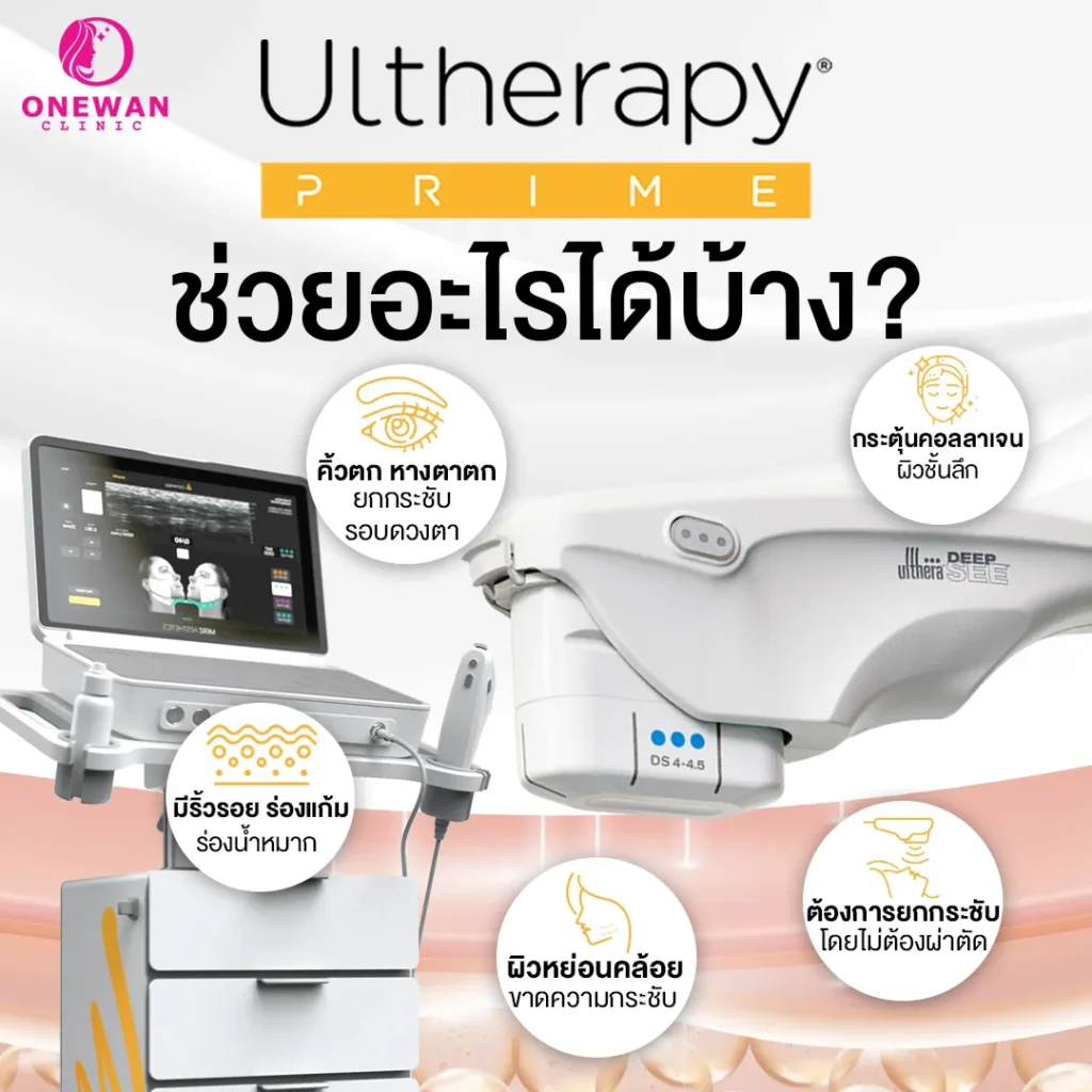 Ulthera Prime ช่วยอะไรได้บ้าง